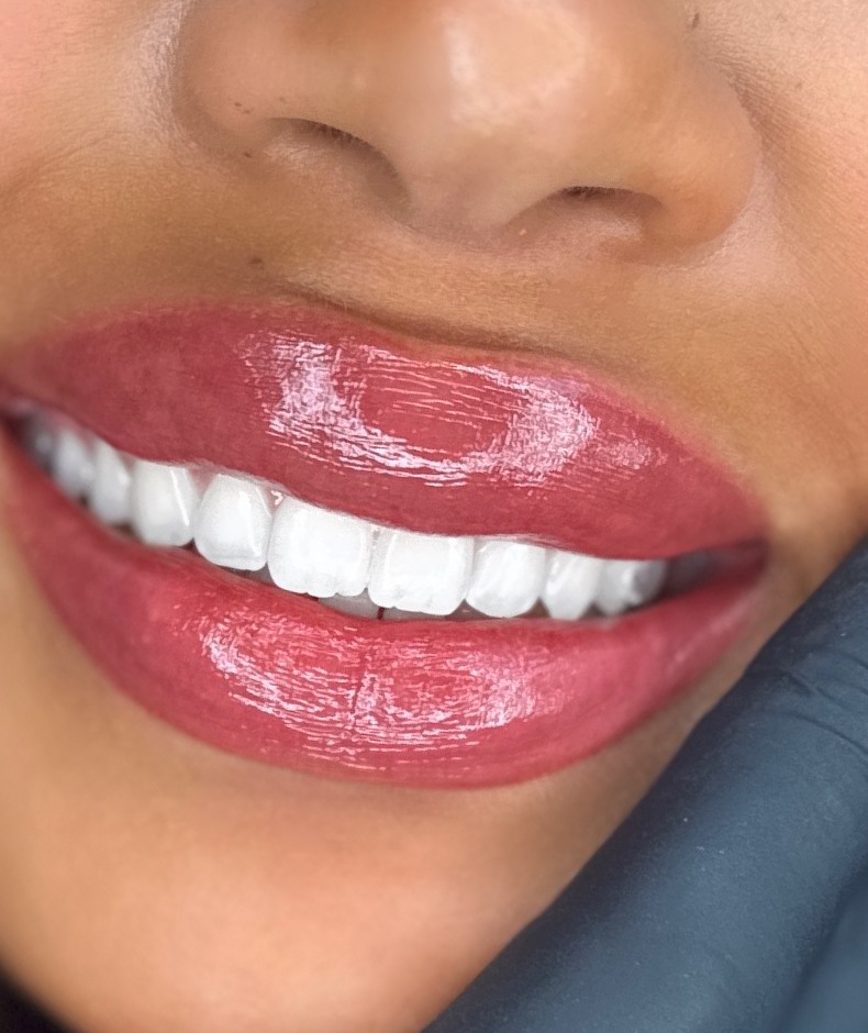 Lachende klant met lip blush, handen van de PMU-artist om het gezicht