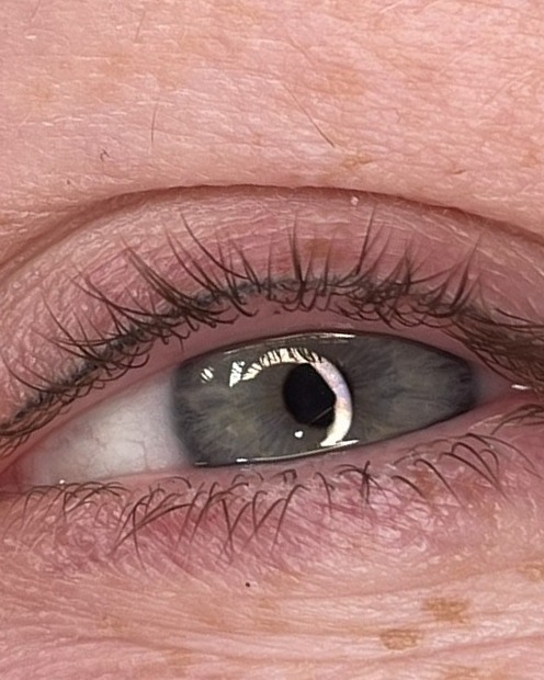 Oog van een klant, close-up na de behandeling